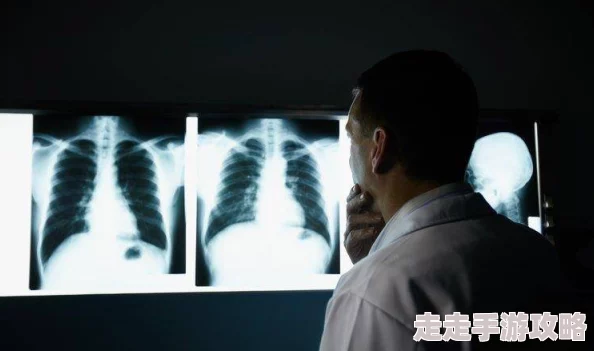 十大曝光胸片：揭示医学影像背后的故事与健康警示，助力公众关注肺部健康问题